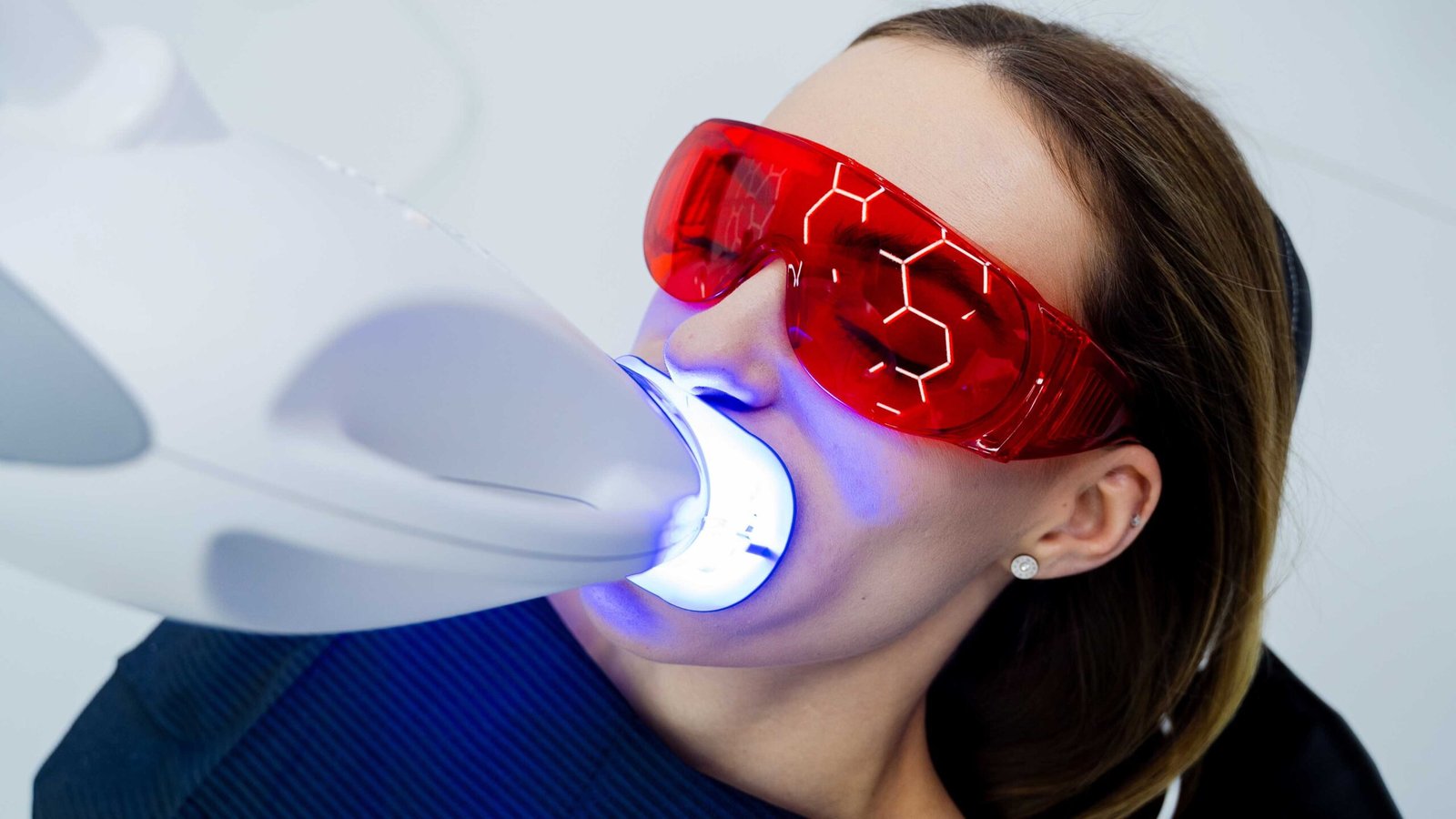 Teeth Whitening