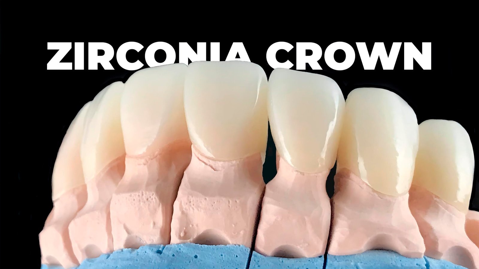 Zirconia Crown